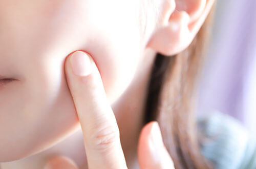 シミ取り治療の効果を高めるためのポイント