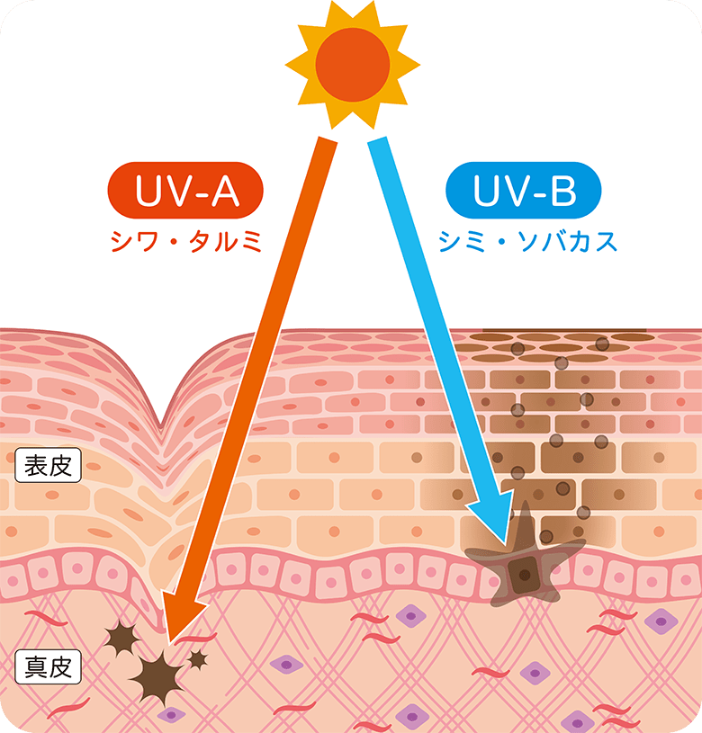 シミが出来る原因、光老化とは？