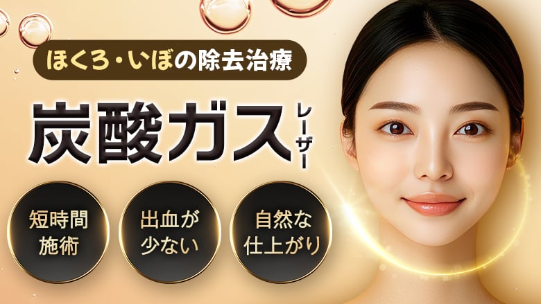 炭酸ガスレーザー（CO2レーザー）