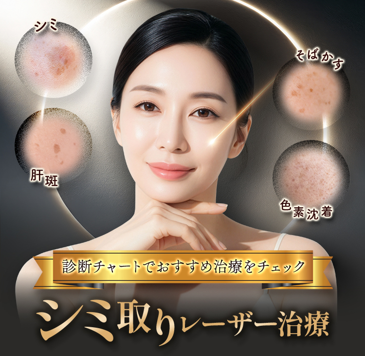 診断チャートでおすすめ治療をチェック シミ取りレーザー治療 シミ・肝斑・そばかす・色素沈着