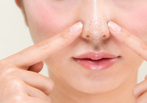 ダーマペンでいちご鼻を治療したい！効果や鼻のみの治療できるか解説