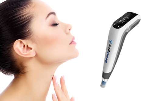 ニキビ跡治療として有名な「ダーマペン」