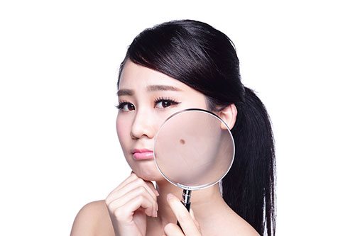 「顔のほくろを取りたい！」美容外科での施術の流れ