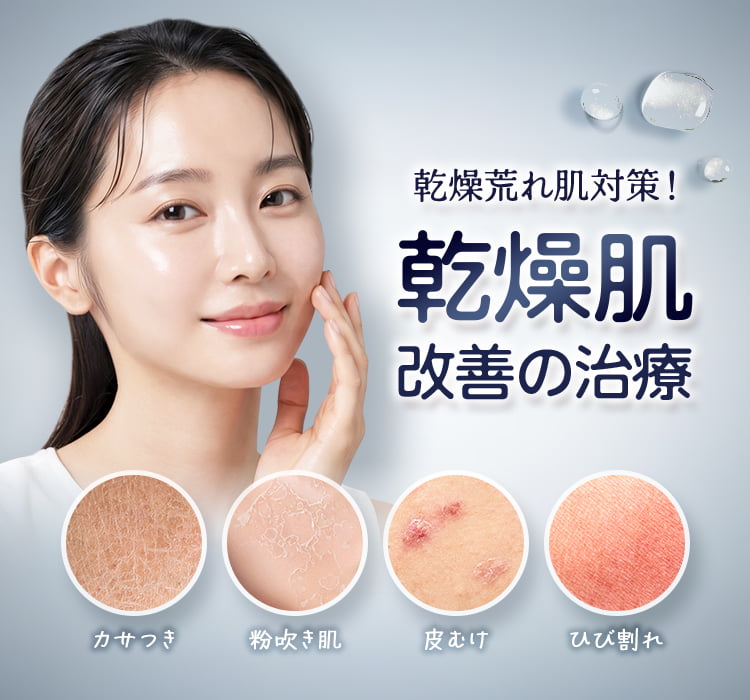 乾燥荒れ肌対策！乾燥肌改善の治療 カサつき・粉吹き肌・皮むけ・ひび割れ
