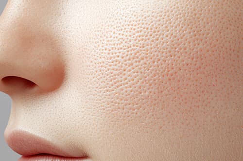 毛穴の開きを引き起こす主な原因3つ