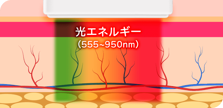 他のIPLでは反応しにくい薄いシミにも効果的！