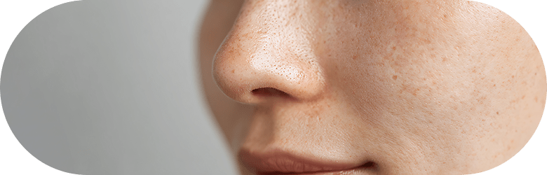 ルクセアの効果