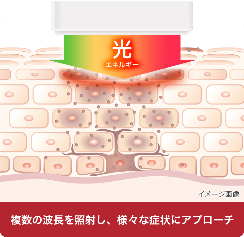 複数の波長を照射し、様々な症状にアプローチ