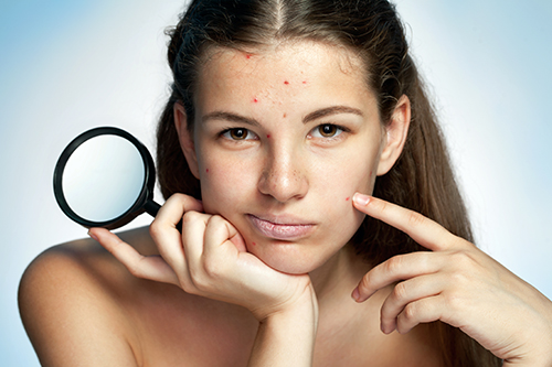 ニキビをニキビ跡にしないためには？