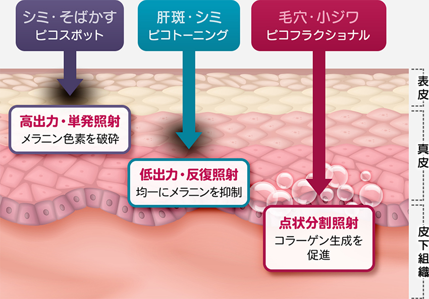 モード別の照射範囲【画像】