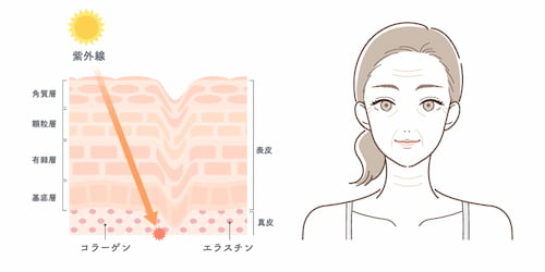 紫外線（UV-A）によるダメージ