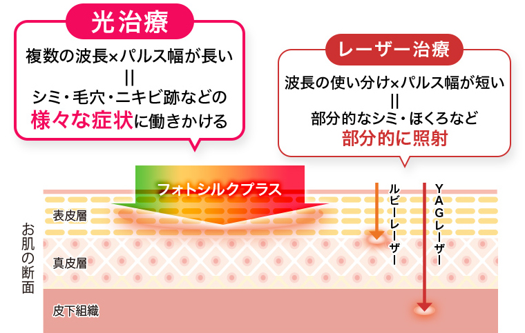 光治療とレーザー治療の違い