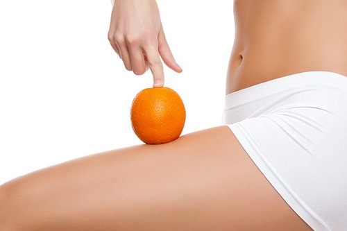 セルライトの形成過程