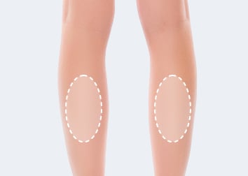 ふくらはぎ